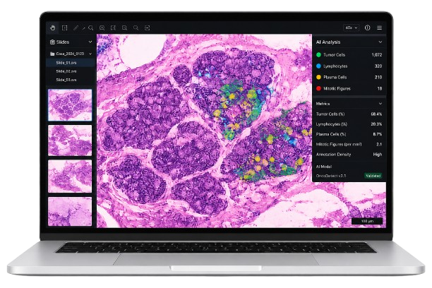 CroPath Pathology AI Annotator Mockup